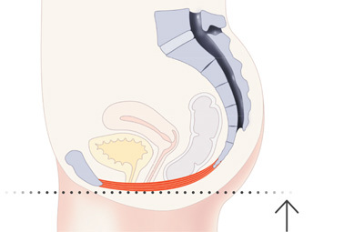 Pelvic Floor Healed